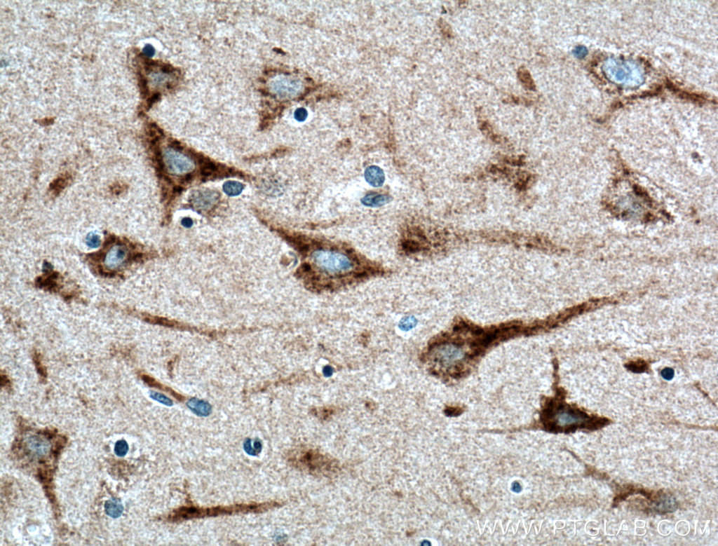 TMEM230 Polyclonal antibody