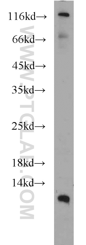 DMRTC1B Polyclonal antibody