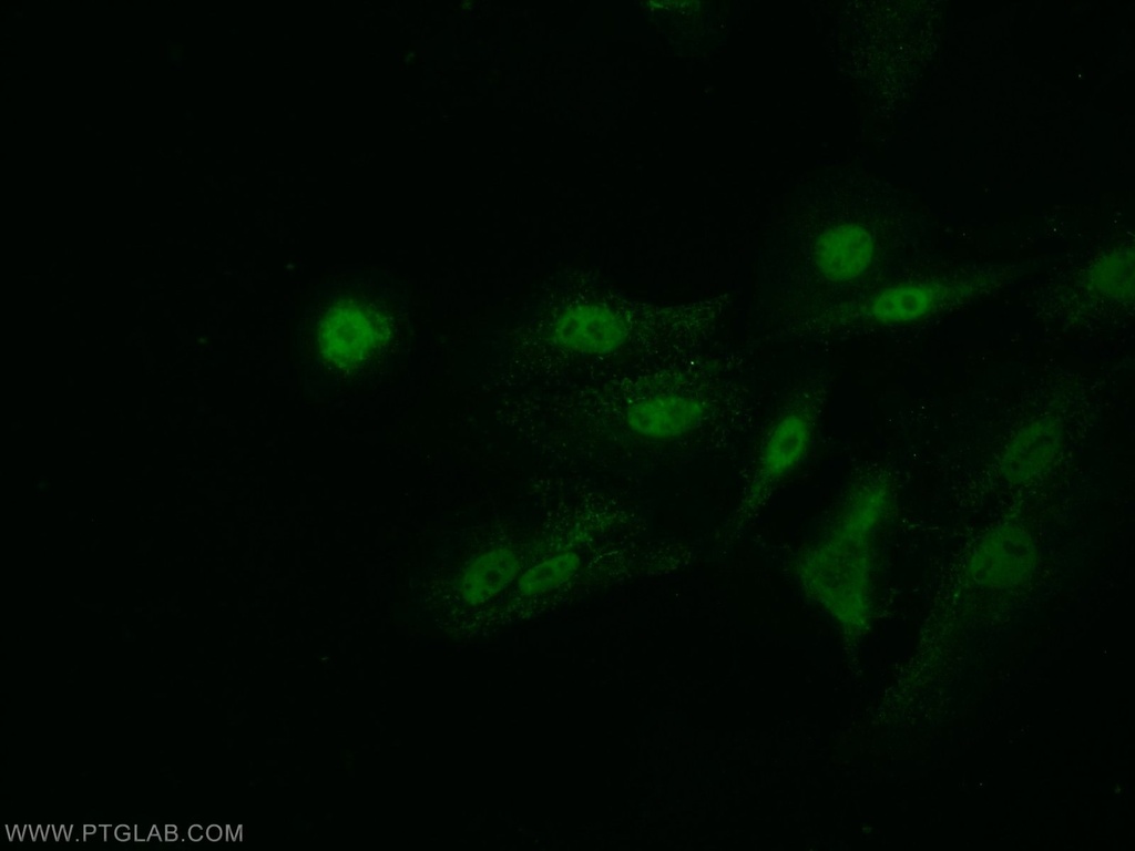 Arp5/ACTR5 Polyclonal antibody