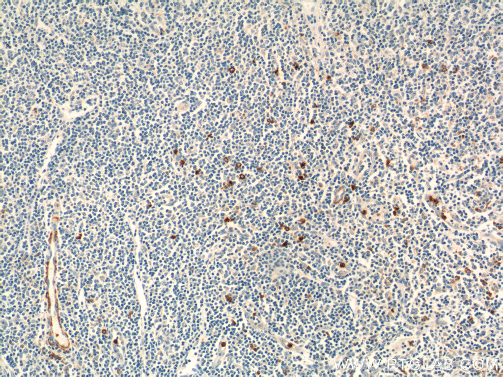 KLRF1 Polyclonal antibody