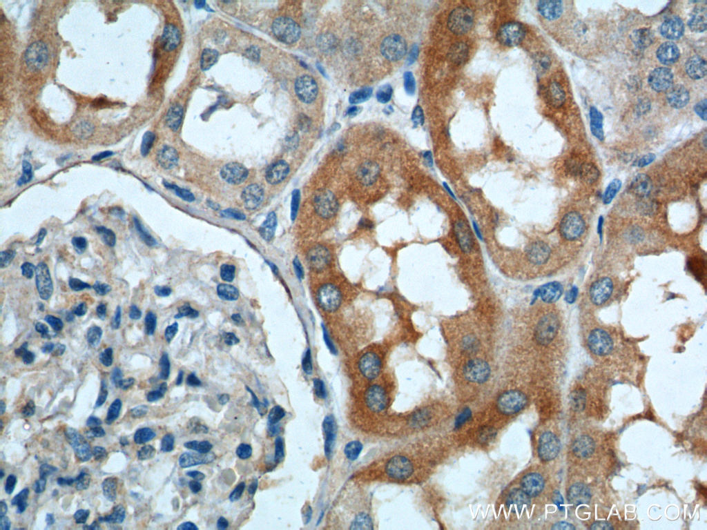 SLC4A1AP Polyclonal antibody