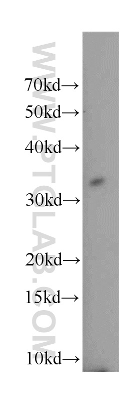 TNFRSF13B Polyclonal antibody