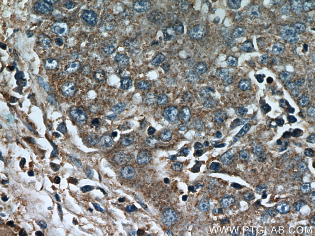 CCT4 Polyclonal antibody