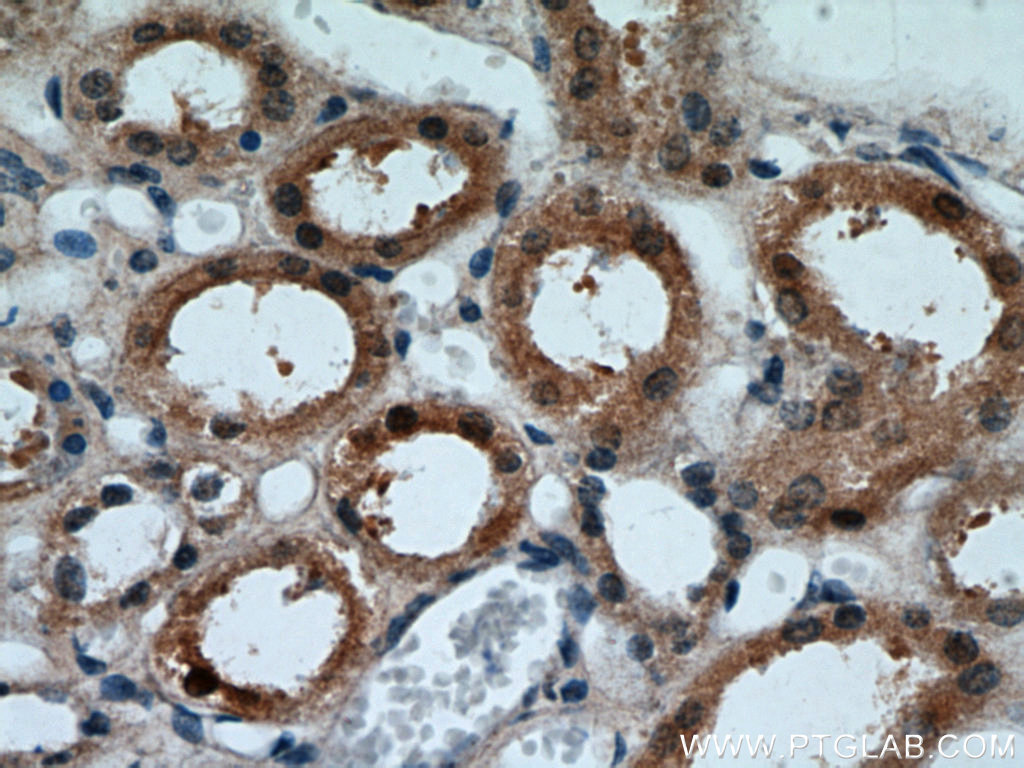 FOXO4 Polyclonal antibody