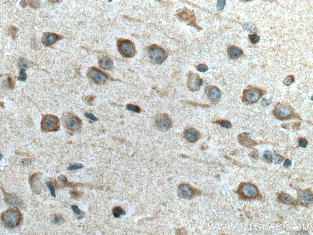 FAM134B Polyclonal antibody