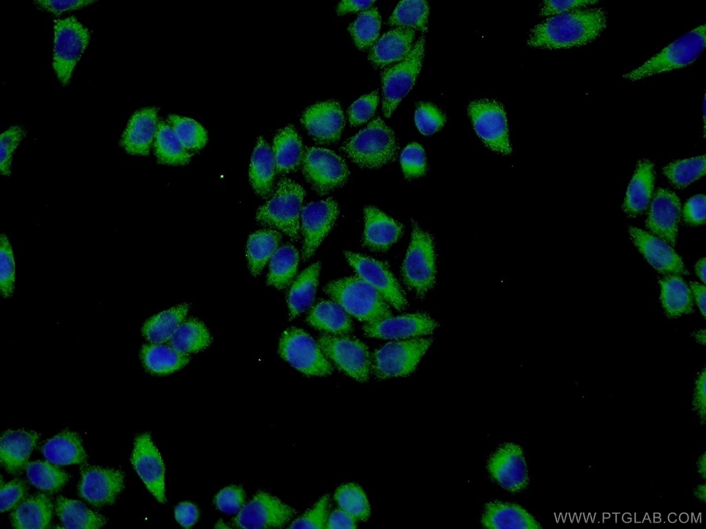 ISM2 Polyclonal antibody