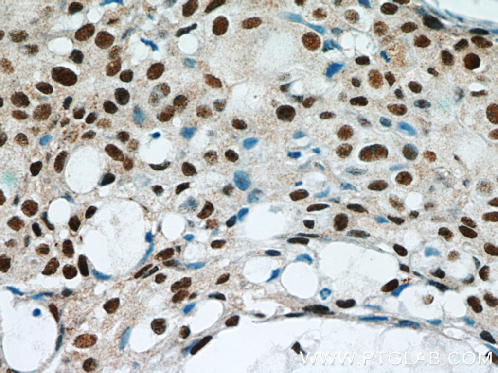 GABPA Polyclonal antibody