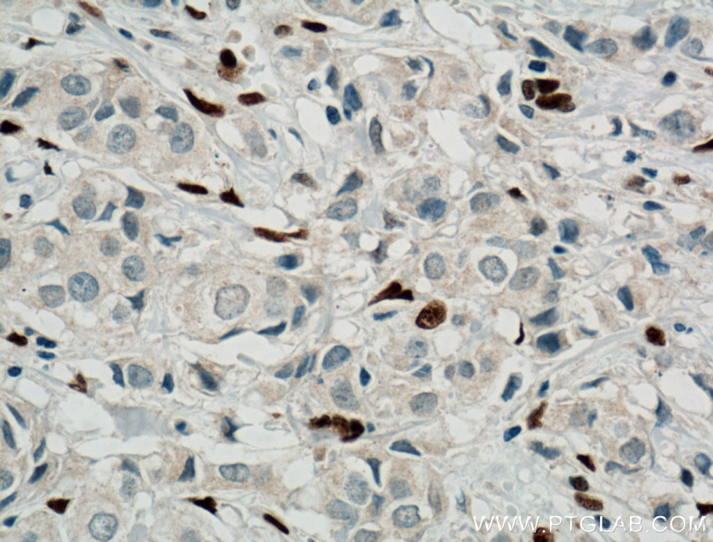 ZEB1 Polyclonal antibody