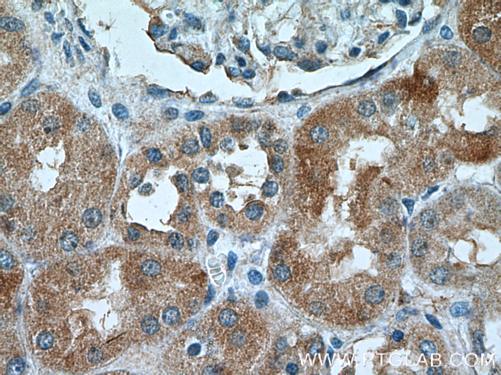 NRBP2 Polyclonal antibody