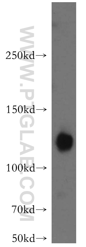 ATP8A1 Polyclonal antibody