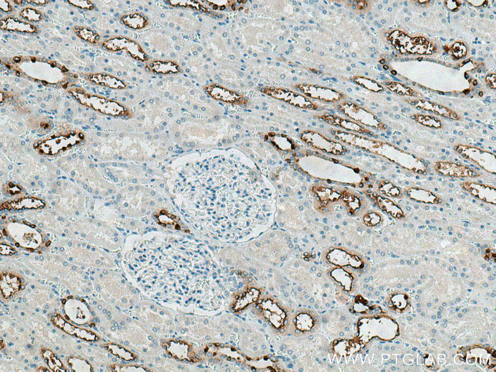 ATP6V0A4 Polyclonal antibody