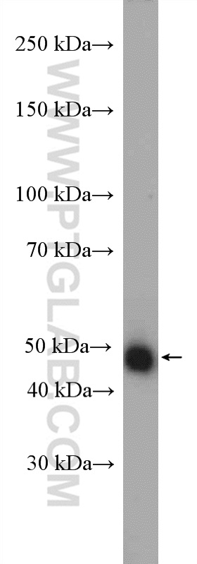 JMJD4 Polyclonal antibody