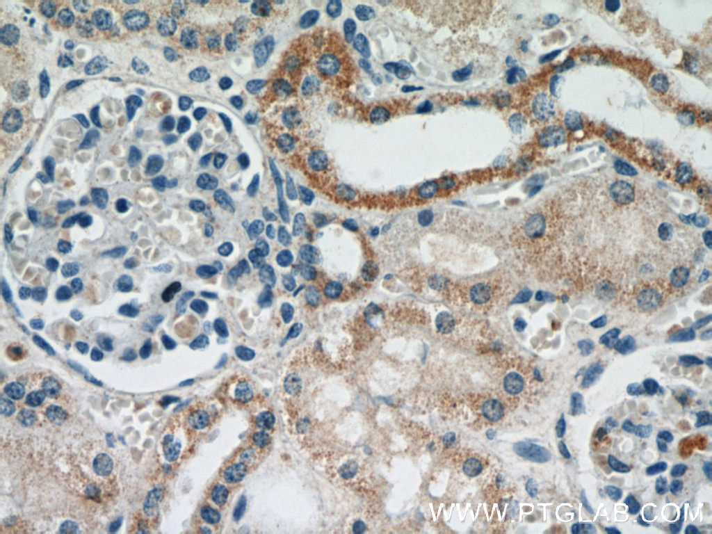 CYP24A1 Polyclonal antibody