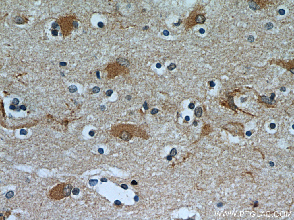 OGFOD2 Polyclonal antibody