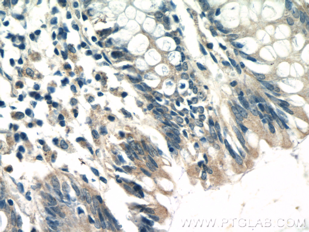 TTC7A Polyclonal antibody