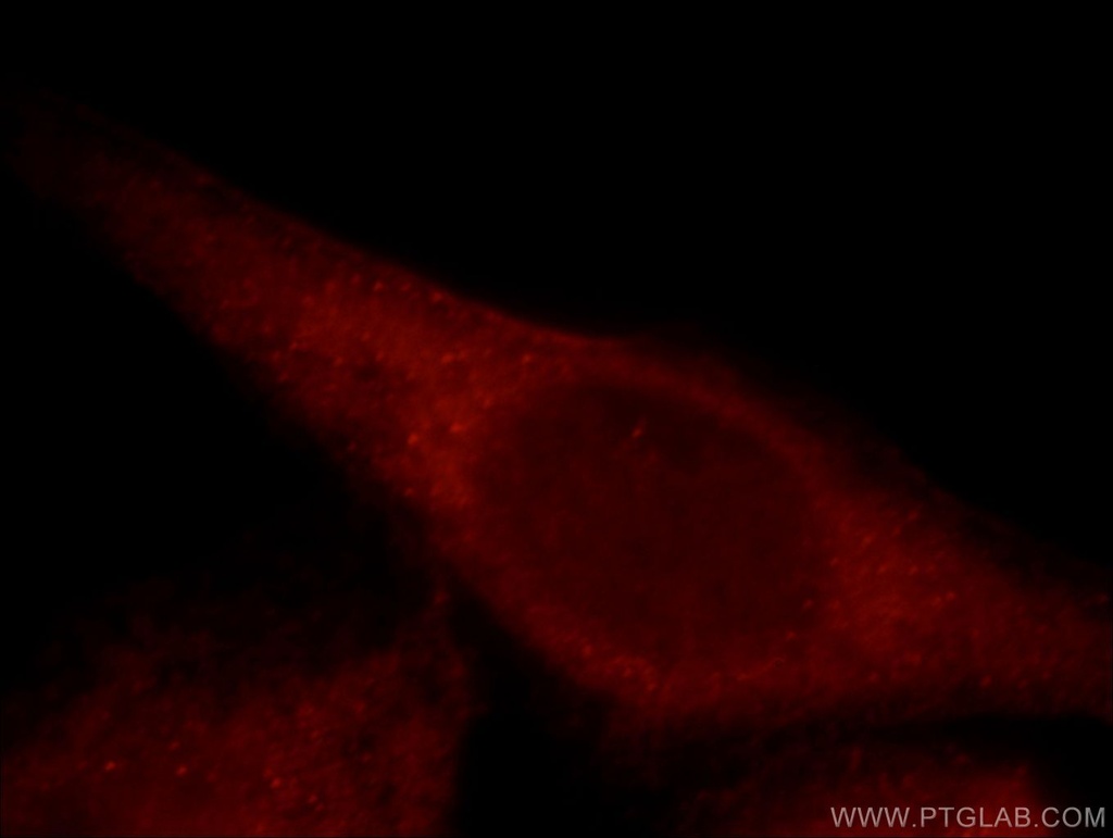 MAP3K4 Polyclonal antibody