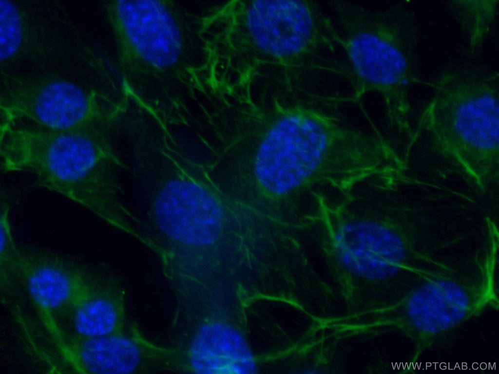 Adiponectin Polyclonal antibody