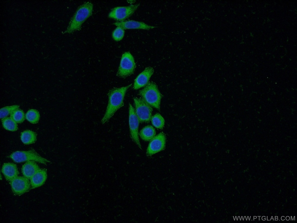FHL2 Polyclonal antibody