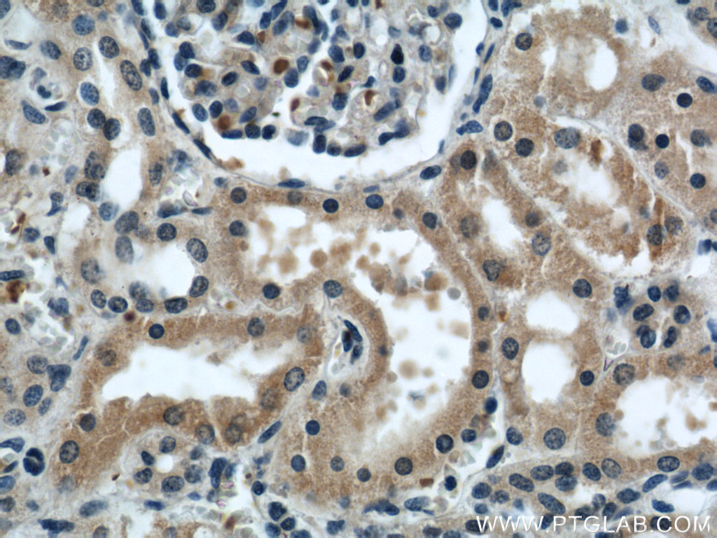 KIF5B Polyclonal antibody