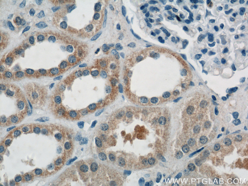 AKT3 Polyclonal antibody