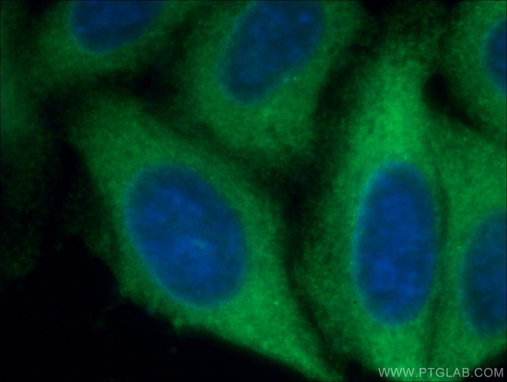 ROCK2(middle) Polyclonal antibody