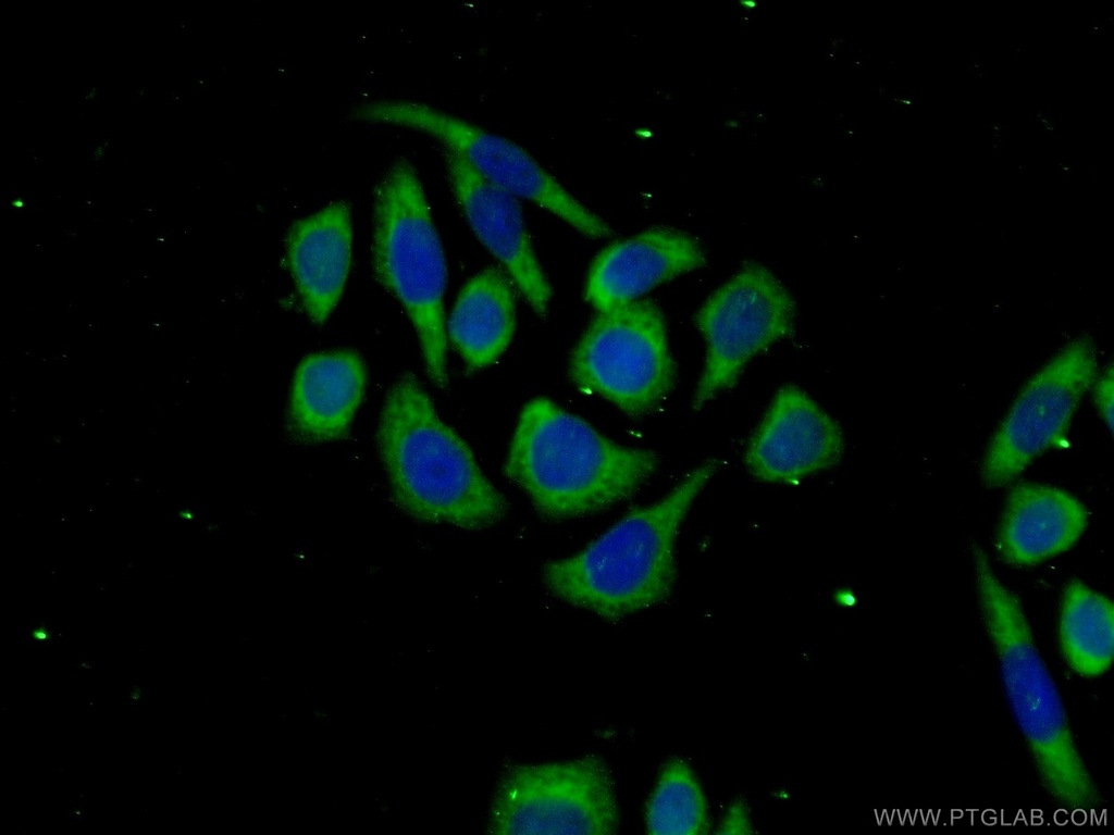 TTC31 Polyclonal antibody