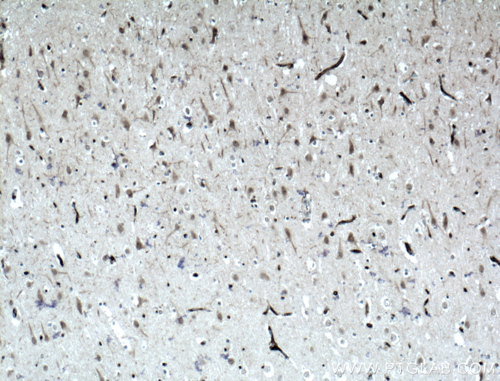 Teneurin 1 Polyclonal antibody