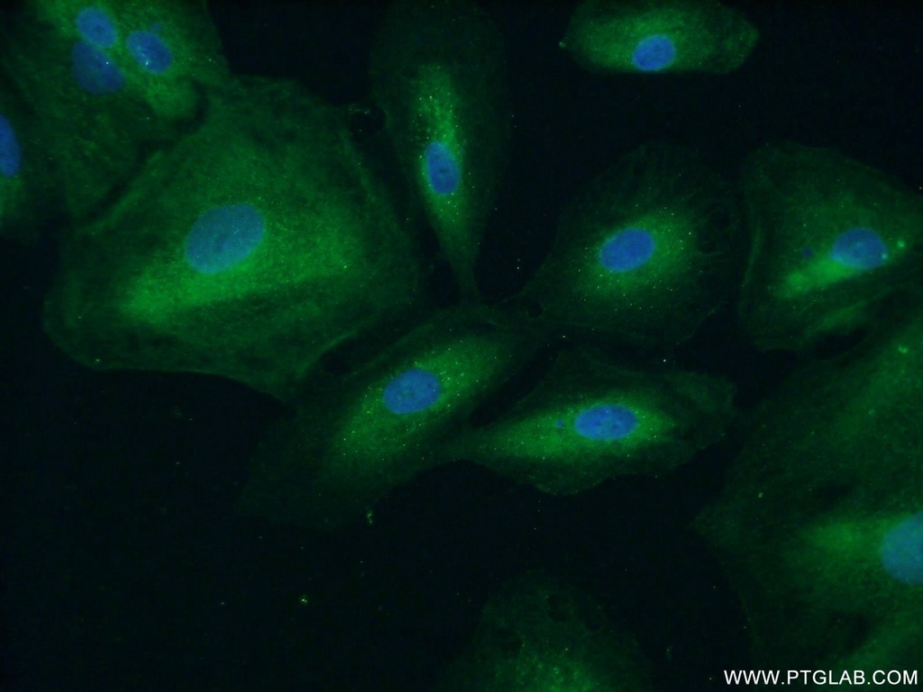 APAF1 Polyclonal antibody