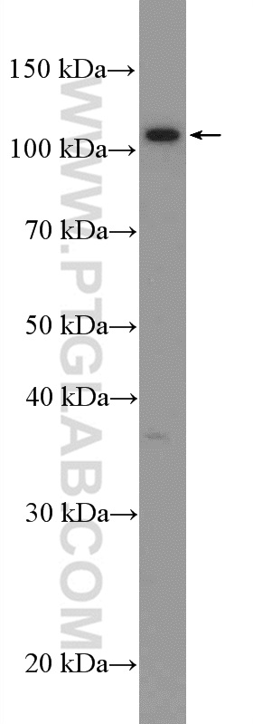 CACNA2D3 Polyclonal antibody