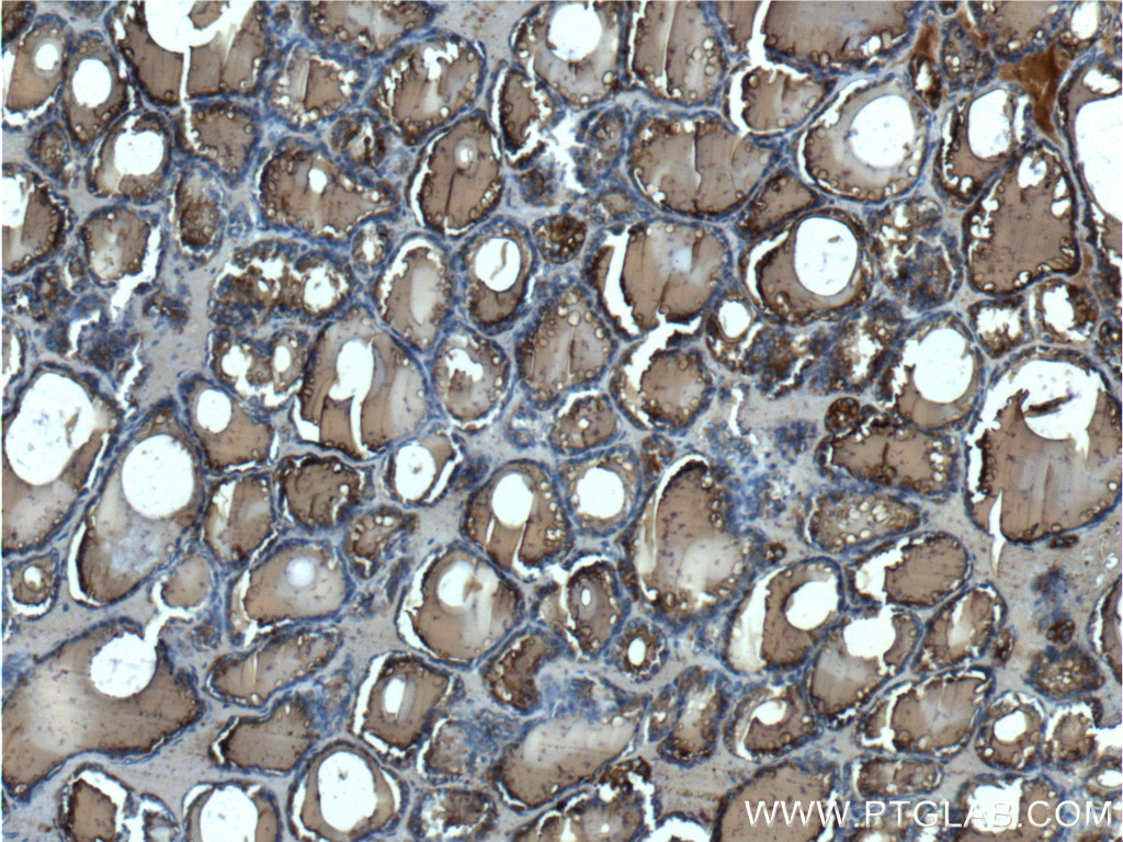 Thyroglobulin Polyclonal antibody