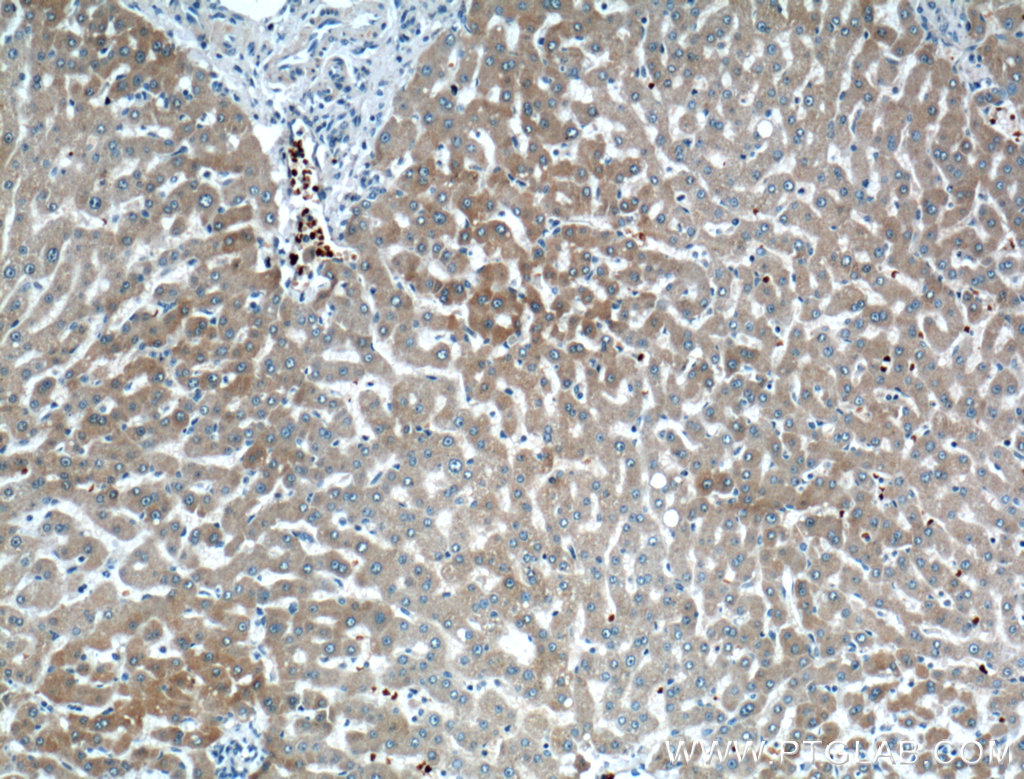CYP2A6 Polyclonal antibody