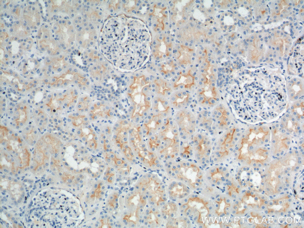 SLC13A2 Polyclonal antibody