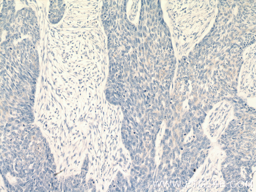 KRT2 Polyclonal antibody