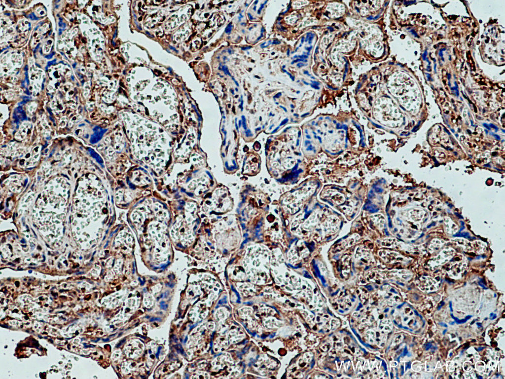 pregnancy zone protein Polyclonal antibody