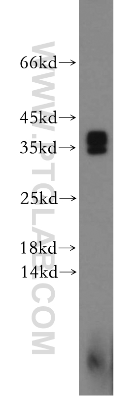 Synaptogyrin-4 Polyclonal antibody