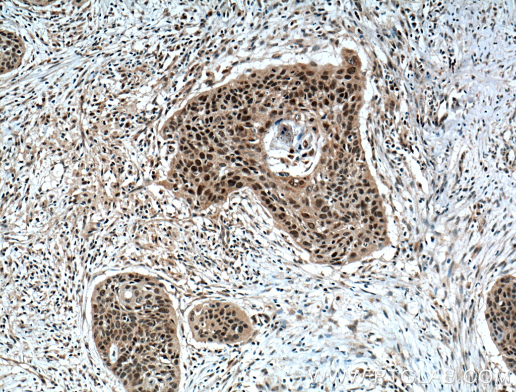 ZNF750 Polyclonal antibody