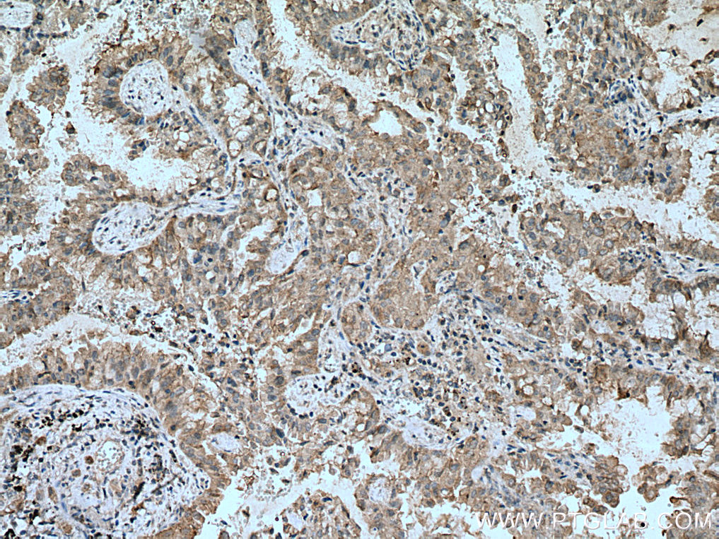 RASSF7 Polyclonal antibody
