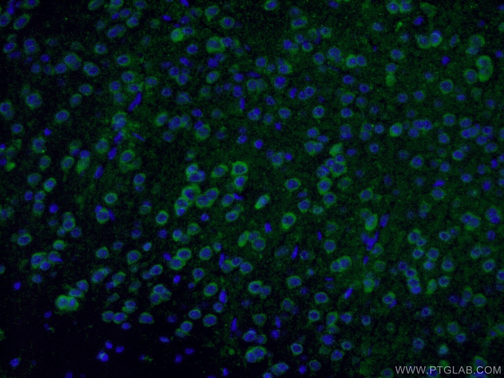 GAD65 Polyclonal antibody
