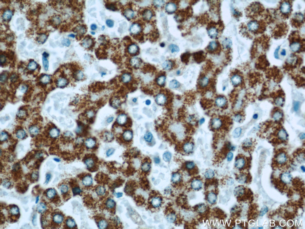 SLC25A2 Polyclonal antibody