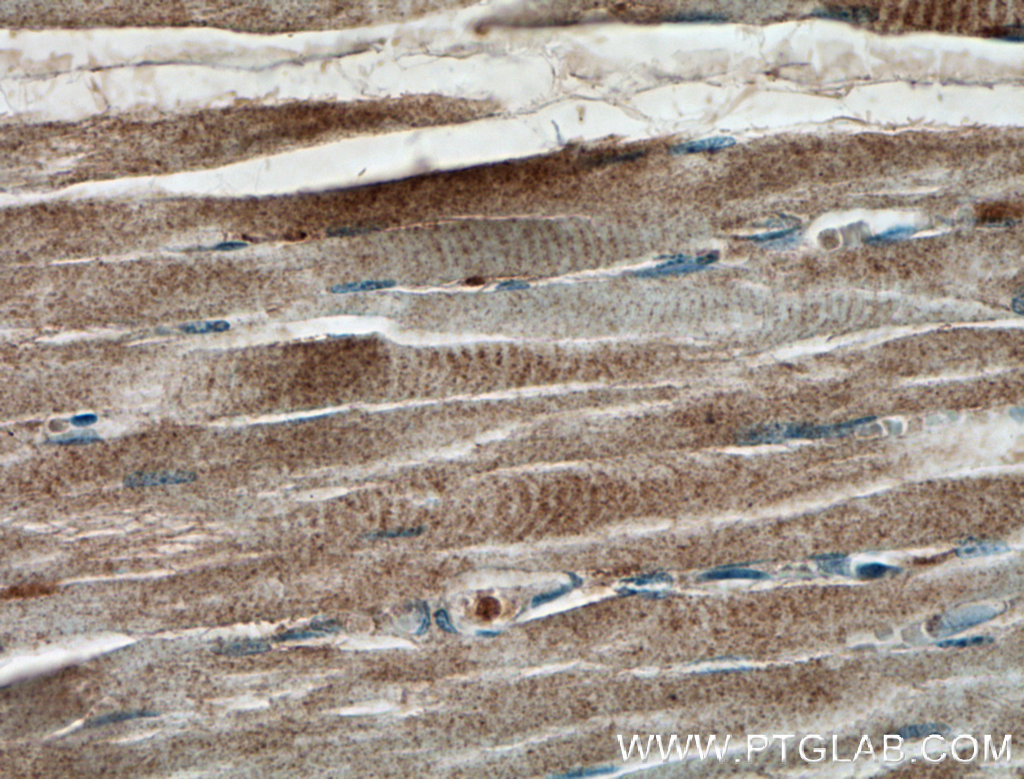 IFIH1/MDA5 Polyclonal antibody