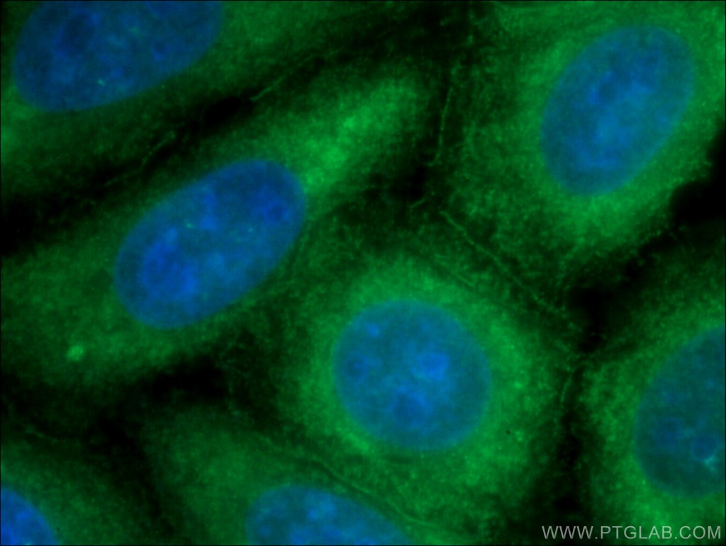 Ataxin 2 Polyclonal antibody