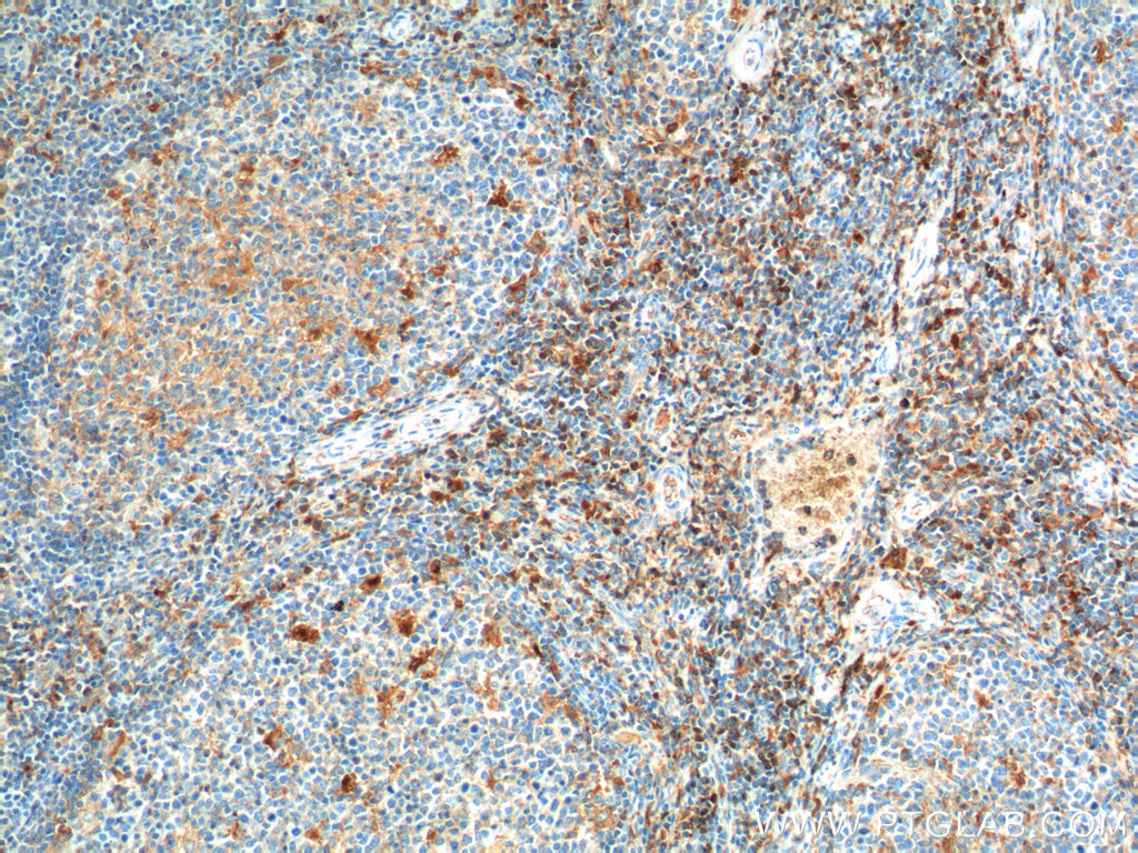 CD52 Polyclonal antibody