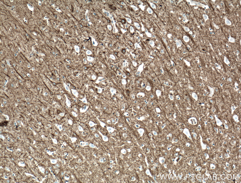 CEP152 Polyclonal antibody