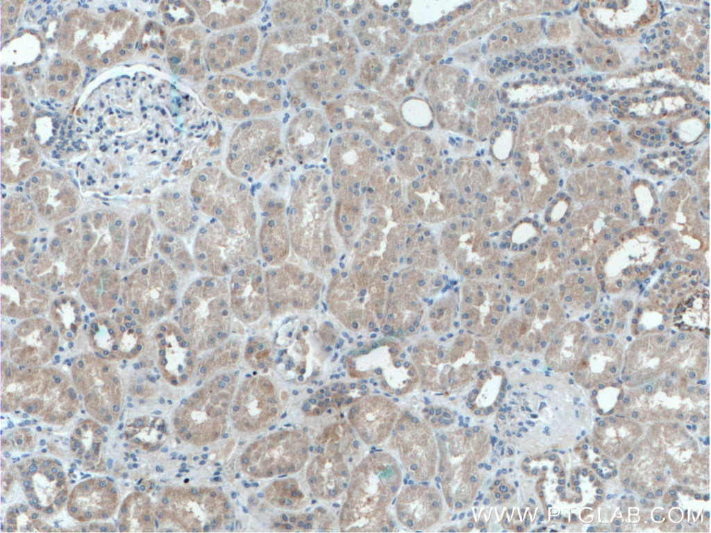 IFRG15 Polyclonal antibody