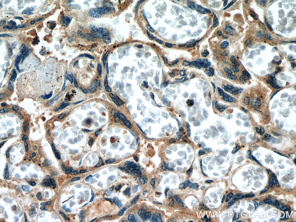 Collagen Type XI Polyclonal antibody