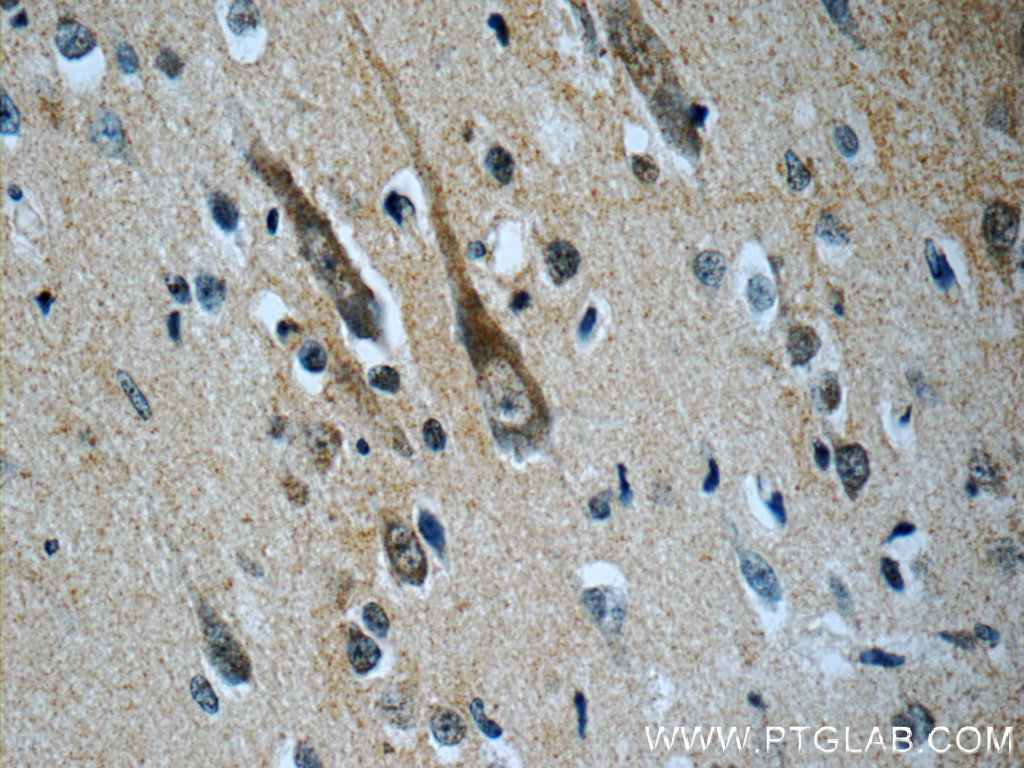CHT1 Polyclonal antibody
