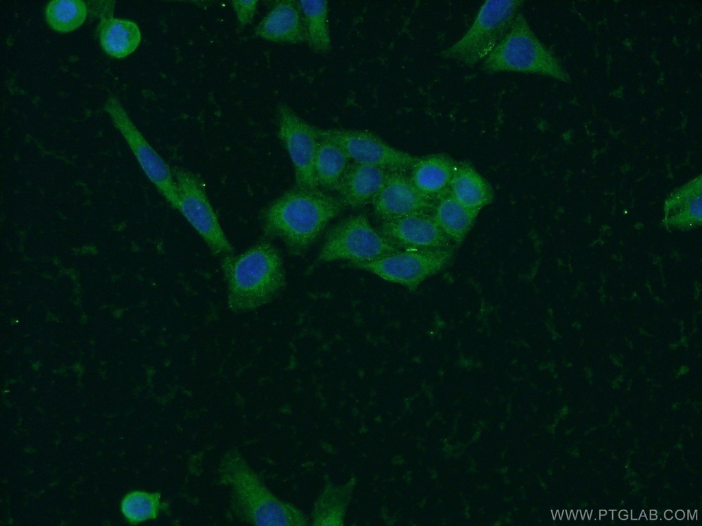 SOAT2 Polyclonal antibody