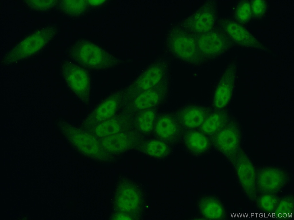 TCERG1 Polyclonal antibody