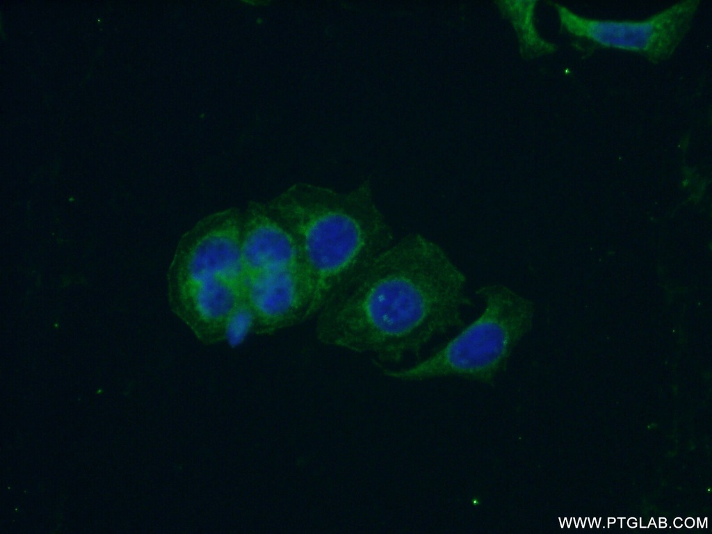 PCDH10 Polyclonal antibody
