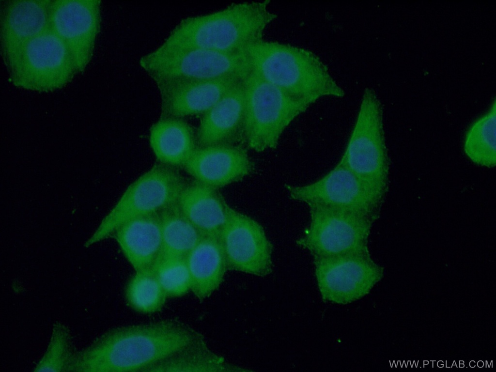 DOCK4 Polyclonal antibody